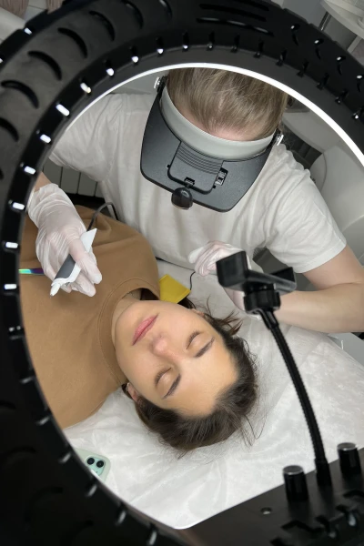 Электроэпиляция Xilia Epil 5